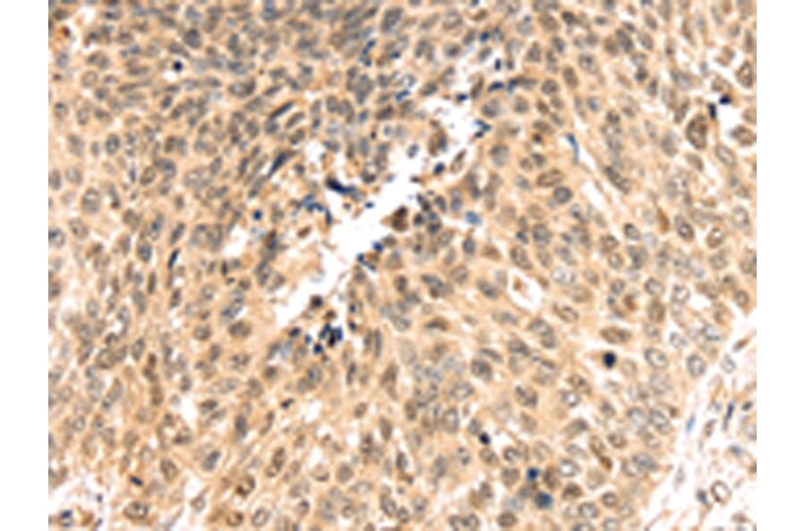 Immunohistochemistry - PSMB8 Antibody from Signalway Antibody (43134) - Antibodies.com