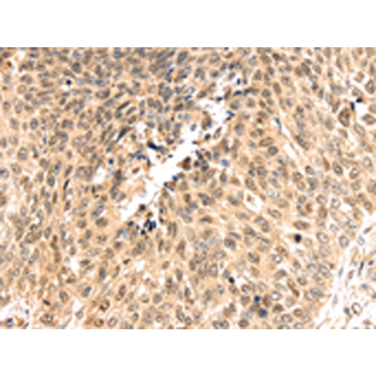 Immunohistochemistry - PSMB8 Antibody from Signalway Antibody (43134) - Antibodies.com