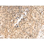 Immunohistochemistry - PSMB8 Antibody from Signalway Antibody (43134) - Antibodies.com