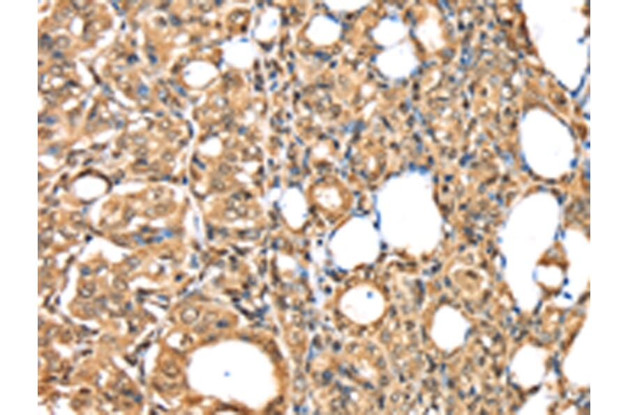 Immunohistochemistry - PSMB8 Antibody from Signalway Antibody (43134) - Antibodies.com