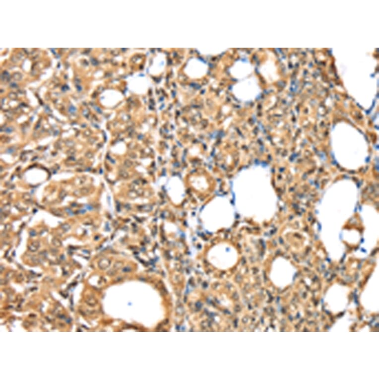 Immunohistochemistry - PSMB8 Antibody from Signalway Antibody (43134) - Antibodies.com