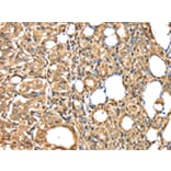 Immunohistochemistry - PSMB8 Antibody from Signalway Antibody (43134) - Antibodies.com