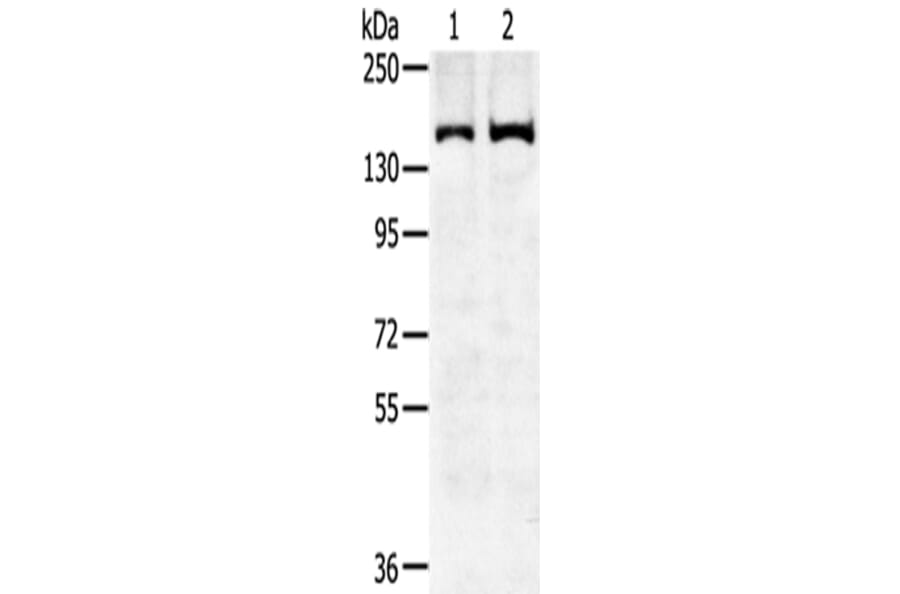 SENP6 Antibody from Signalway Antibody (43143) - Antibodies.com