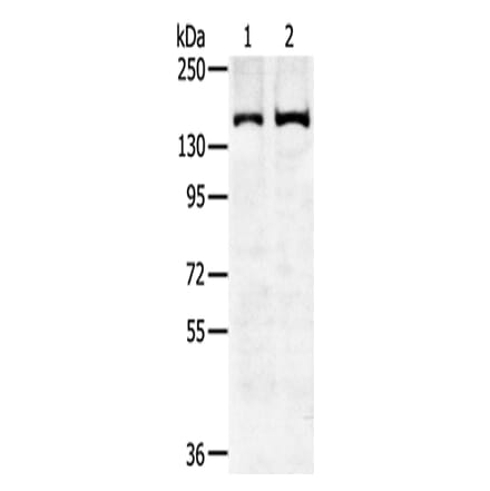 SENP6 Antibody from Signalway Antibody (43143) - Antibodies.com