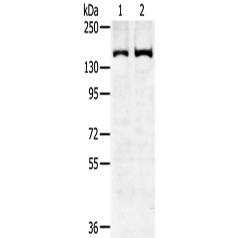 SENP6 Antibody from Signalway Antibody (43143) - Antibodies.com