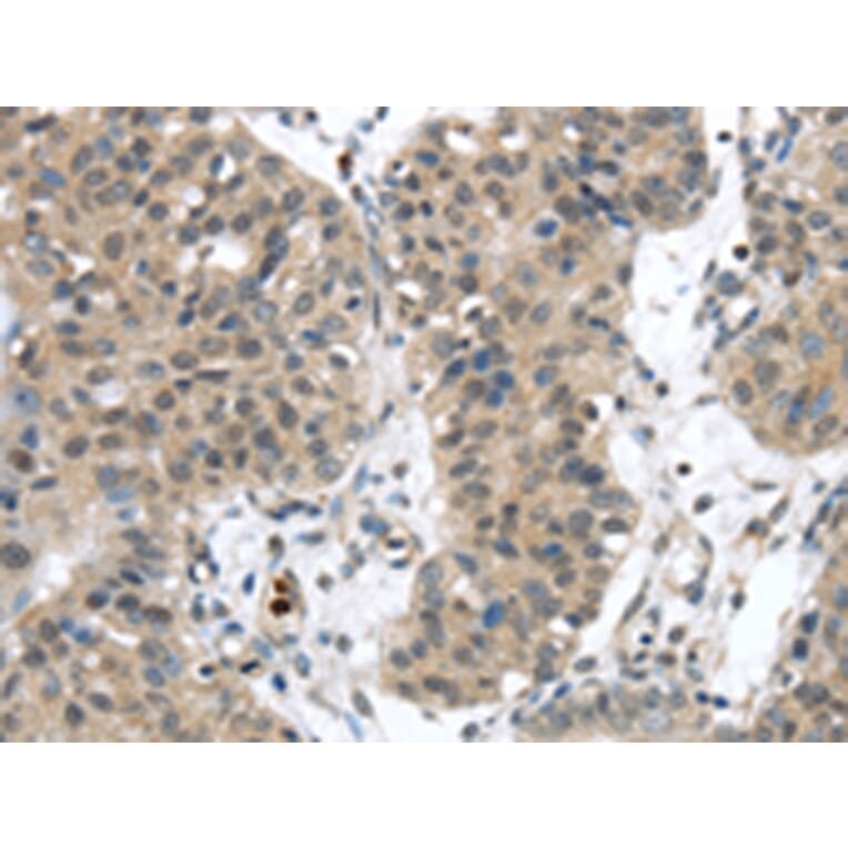 Immunohistochemistry - SENP6 Antibody from Signalway Antibody (43143) - Antibodies.com
