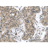 Immunohistochemistry - SENP6 Antibody from Signalway Antibody (43143) - Antibodies.com