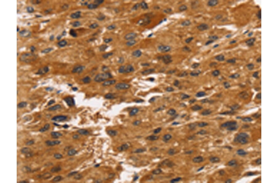 Immunohistochemistry - TACC2 Antibody from Signalway Antibody (43154) - Antibodies.com