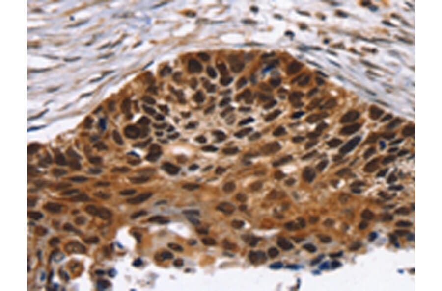 Immunohistochemistry - TACC2 Antibody from Signalway Antibody (43154) - Antibodies.com