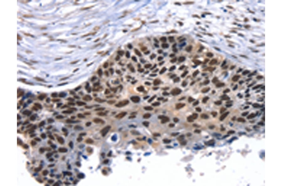 Immunohistochemistry - TAF15 Antibody from Signalway Antibody (43155) - Antibodies.com