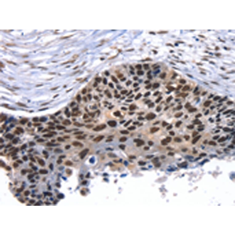 Immunohistochemistry - TAF15 Antibody from Signalway Antibody (43155) - Antibodies.com