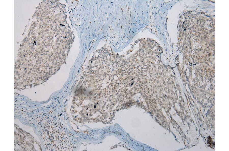 Immunohistochemistry - TUSC5 Antibody from Signalway Antibody (43173) - Antibodies.com