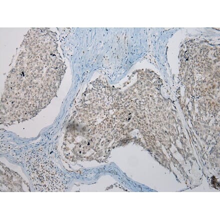 Immunohistochemistry - TUSC5 Antibody from Signalway Antibody (43173) - Antibodies.com