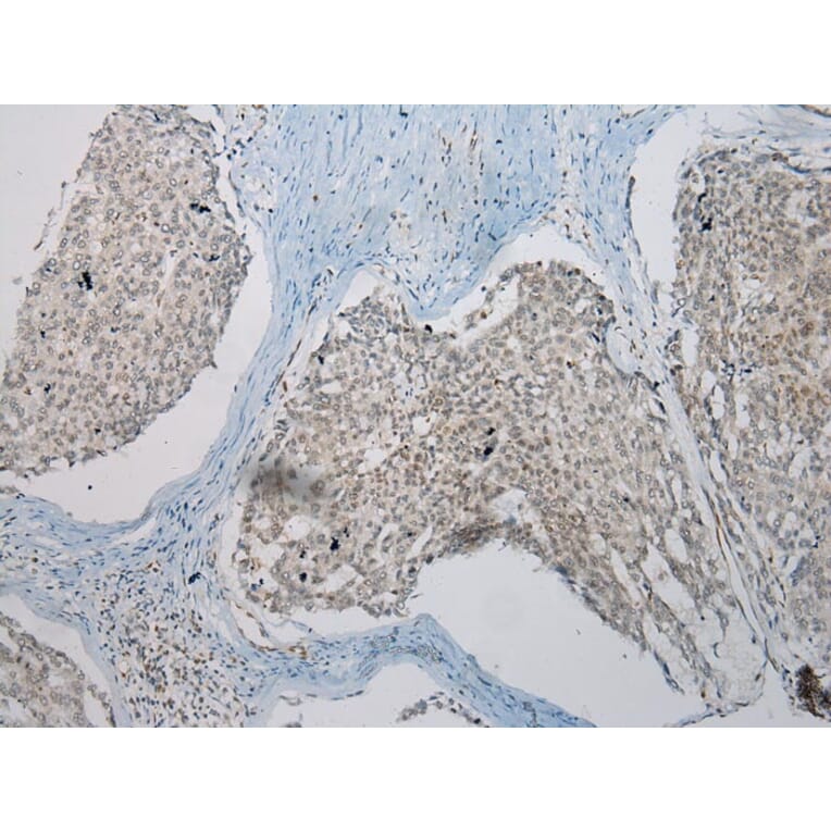 Immunohistochemistry - TUSC5 Antibody from Signalway Antibody (43173) - Antibodies.com