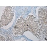 Immunohistochemistry - TUSC5 Antibody from Signalway Antibody (43173) - Antibodies.com
