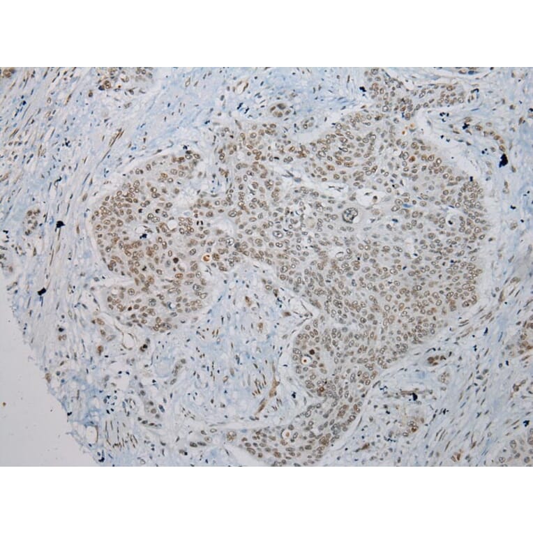 Immunohistochemistry - TUSC5 Antibody from Signalway Antibody (43173) - Antibodies.com