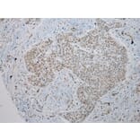 Immunohistochemistry - TUSC5 Antibody from Signalway Antibody (43173) - Antibodies.com