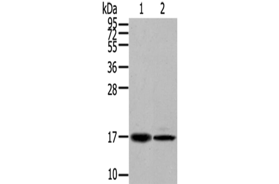TUSC5 Antibody from Signalway Antibody (43173) - Antibodies.com