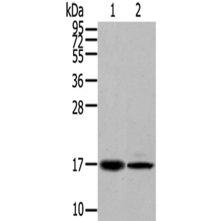 TUSC5 Antibody from Signalway Antibody (43173) - Antibodies.com