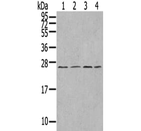 UBTD1 Antibody from Signalway Antibody (43174) - Antibodies.com