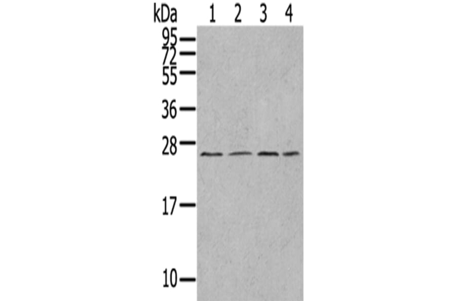 UBTD1 Antibody from Signalway Antibody (43174) - Antibodies.com