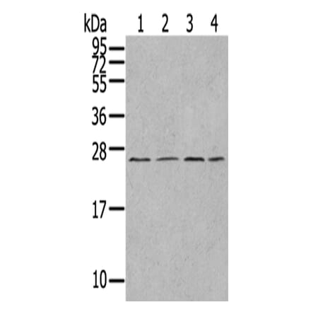 UBTD1 Antibody from Signalway Antibody (43174) - Antibodies.com