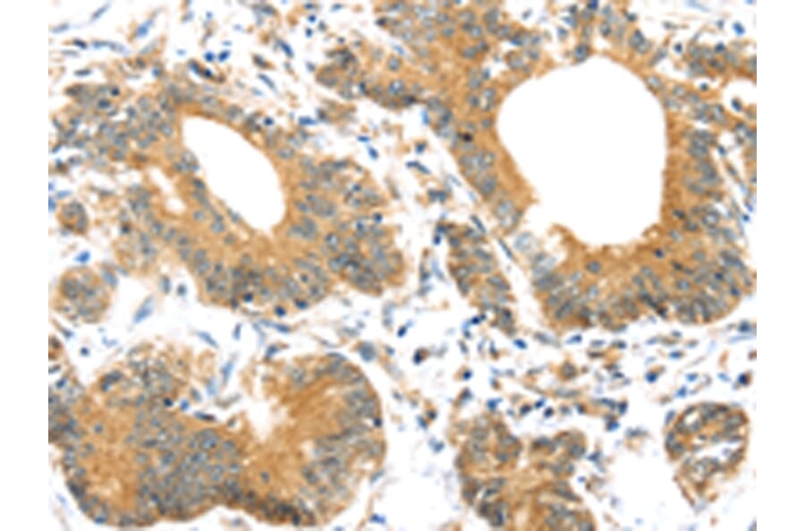 Immunohistochemistry - UBTD1 Antibody from Signalway Antibody (43174) - Antibodies.com