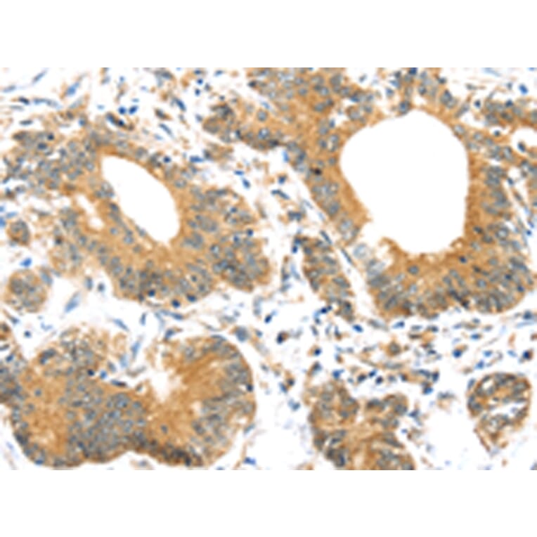 Immunohistochemistry - UBTD1 Antibody from Signalway Antibody (43174) - Antibodies.com