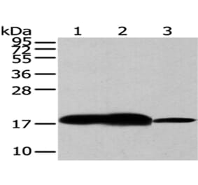 VAMP2 Antibody from Signalway Antibody (43179) - Antibodies.com