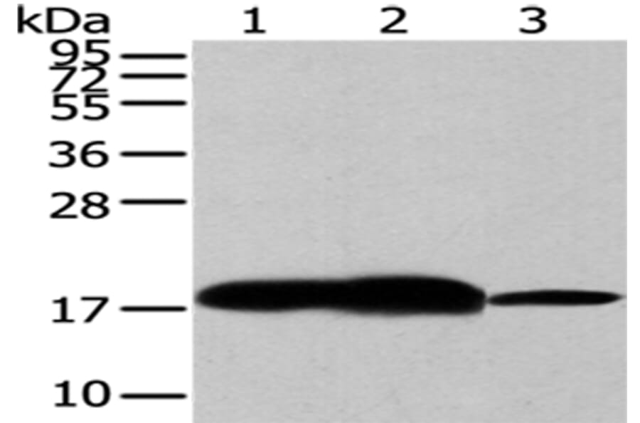 VAMP2 Antibody from Signalway Antibody (43179) - Antibodies.com