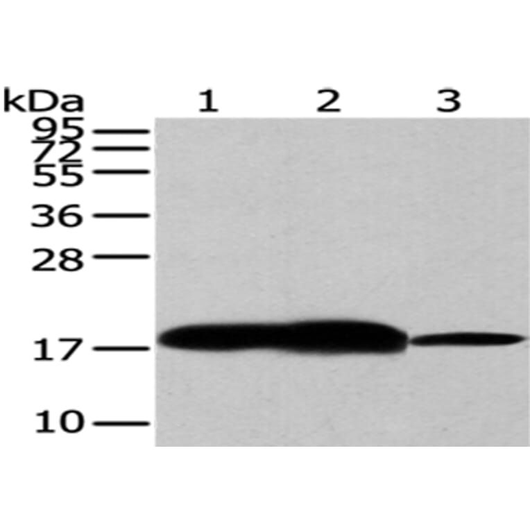VAMP2 Antibody from Signalway Antibody (43179) - Antibodies.com