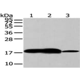 VAMP2 Antibody from Signalway Antibody (43179) - Antibodies.com