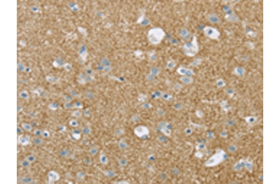 Immunohistochemistry - VAMP2 Antibody from Signalway Antibody (43179) - Antibodies.com