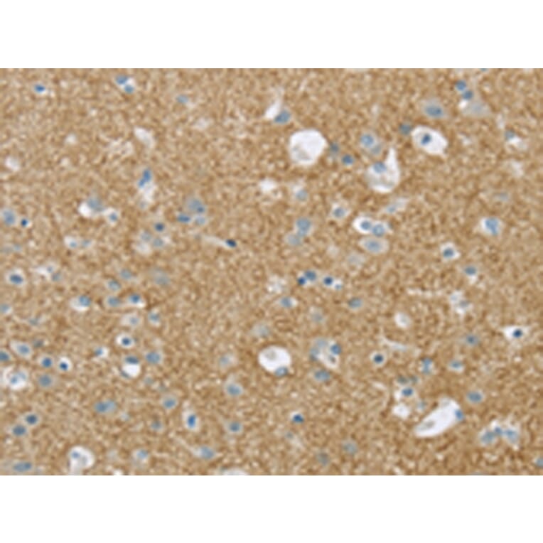 Immunohistochemistry - VAMP2 Antibody from Signalway Antibody (43179) - Antibodies.com