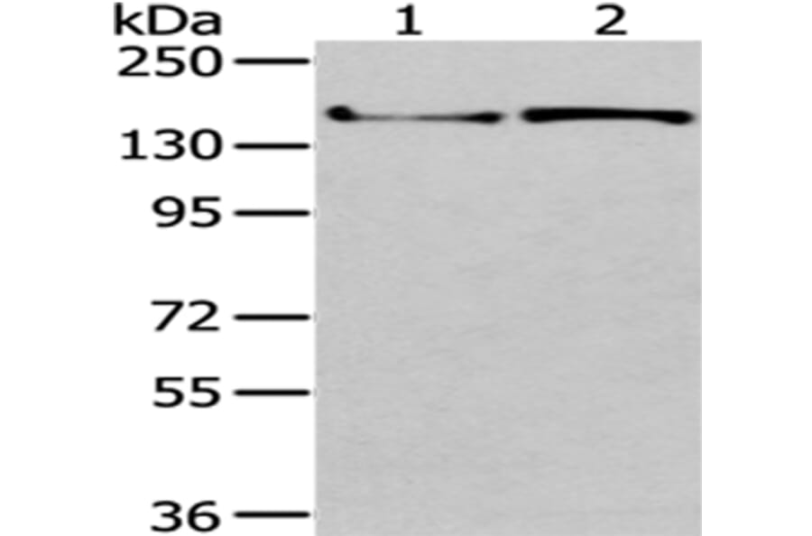 WNK3 Antibody from Signalway Antibody (43190) - Antibodies.com