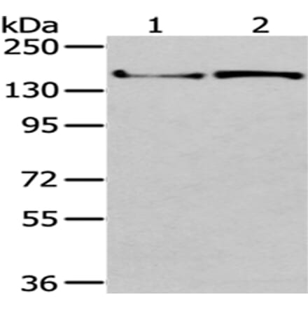 WNK3 Antibody from Signalway Antibody (43190) - Antibodies.com
