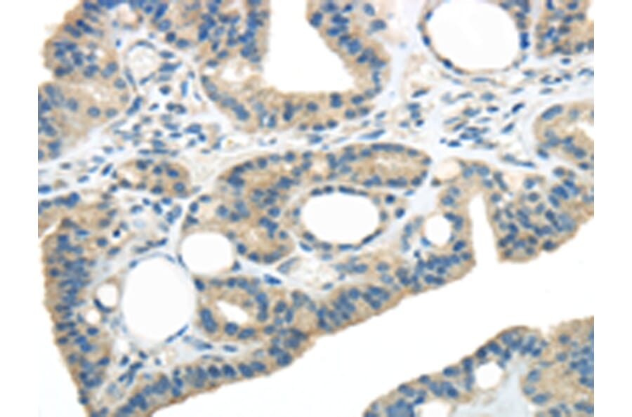 Immunohistochemistry - WNK3 Antibody from Signalway Antibody (43190) - Antibodies.com
