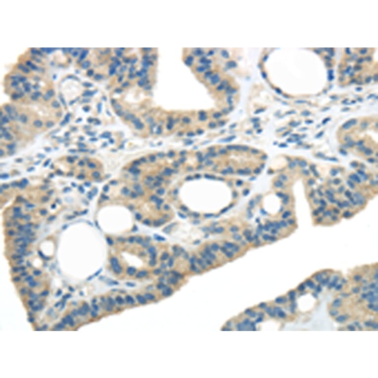 Immunohistochemistry - WNK3 Antibody from Signalway Antibody (43190) - Antibodies.com