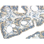 Immunohistochemistry - WNK3 Antibody from Signalway Antibody (43190) - Antibodies.com