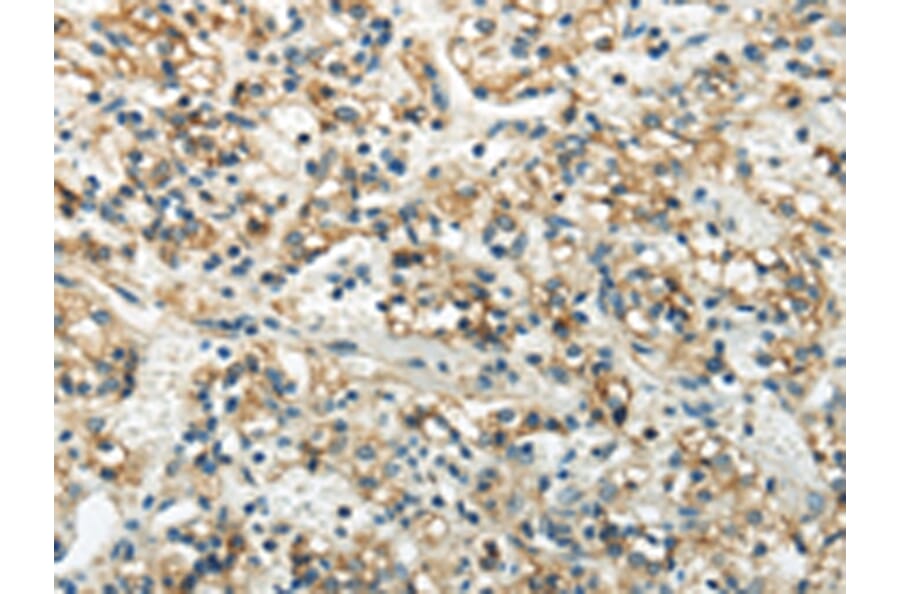 Immunohistochemistry - WNK3 Antibody from Signalway Antibody (43190) - Antibodies.com