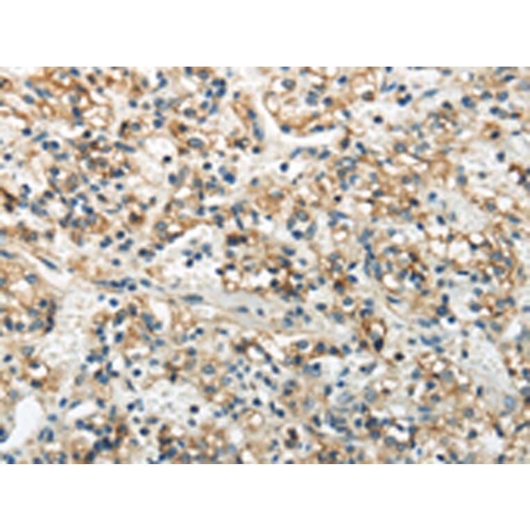 Immunohistochemistry - WNK3 Antibody from Signalway Antibody (43190) - Antibodies.com