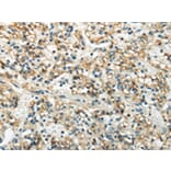 Immunohistochemistry - WNK3 Antibody from Signalway Antibody (43190) - Antibodies.com