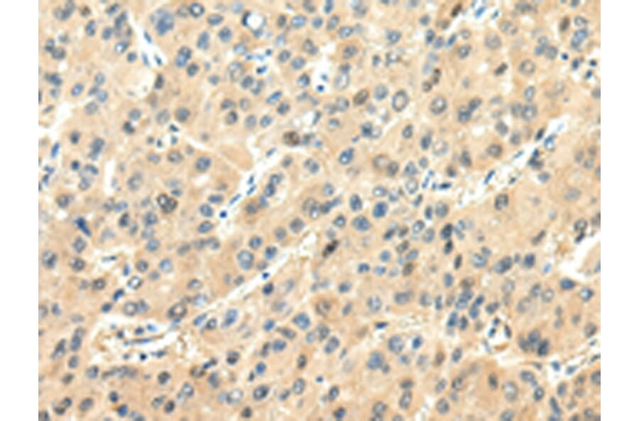 Immunohistochemistry - CHGA Antibody from Signalway Antibody (43191) - Antibodies.com