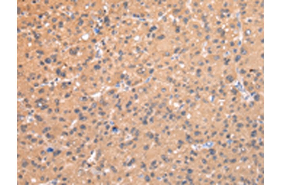Immunohistochemistry - AP2A1 Antibody from Signalway Antibody (43215) - Antibodies.com