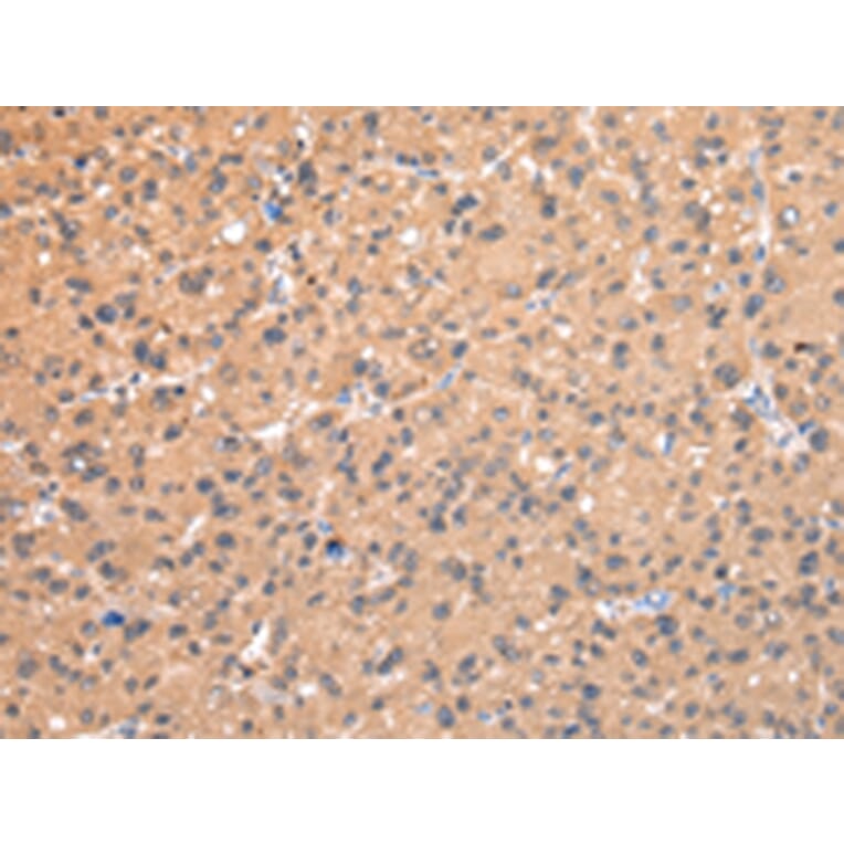 Immunohistochemistry - AP2A1 Antibody from Signalway Antibody (43215) - Antibodies.com