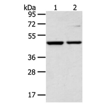 CTBP1 Antibody from Signalway Antibody (43242) - Antibodies.com