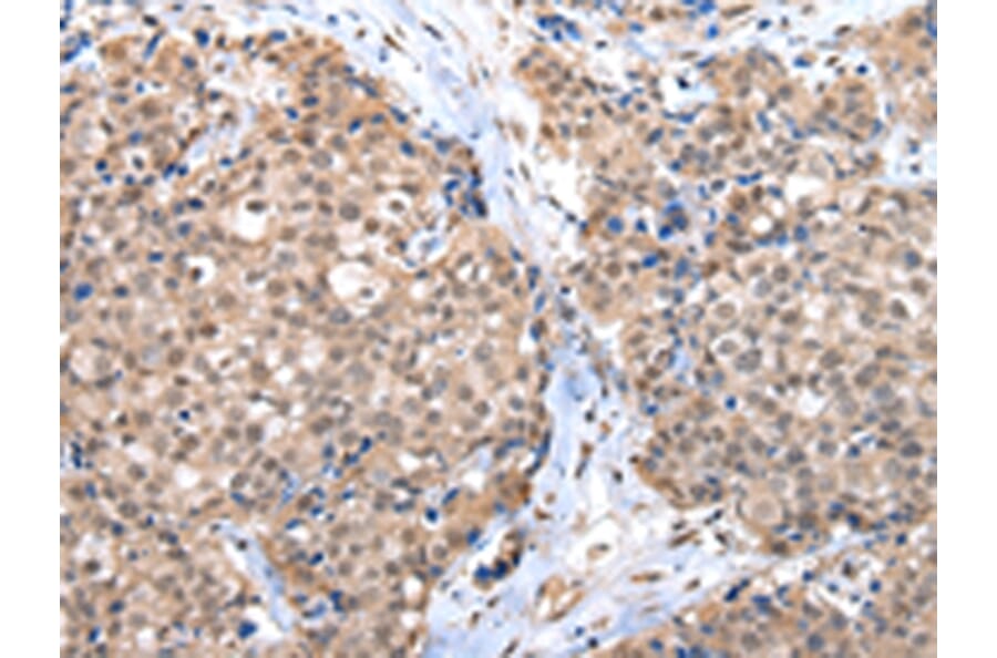 Immunohistochemistry - CTBP1 Antibody from Signalway Antibody (43242) - Antibodies.com