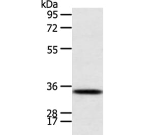 CALB2 Antibody from Signalway Antibody (43244) - Antibodies.com