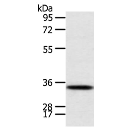 CALB2 Antibody from Signalway Antibody (43244) - Antibodies.com