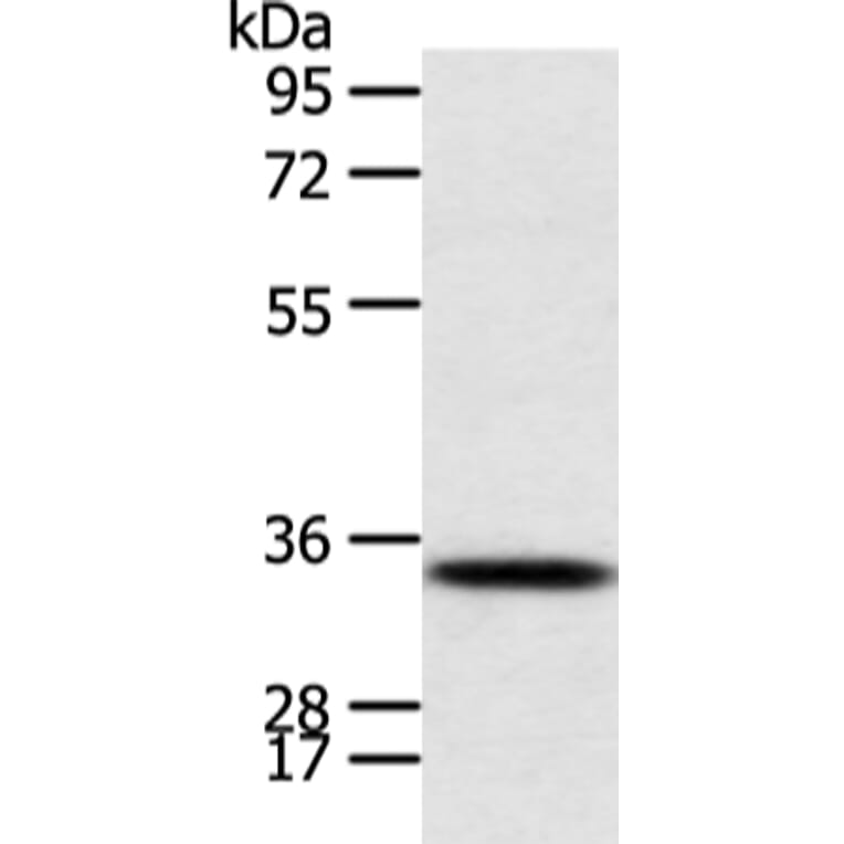 CALB2 Antibody from Signalway Antibody (43244) - Antibodies.com